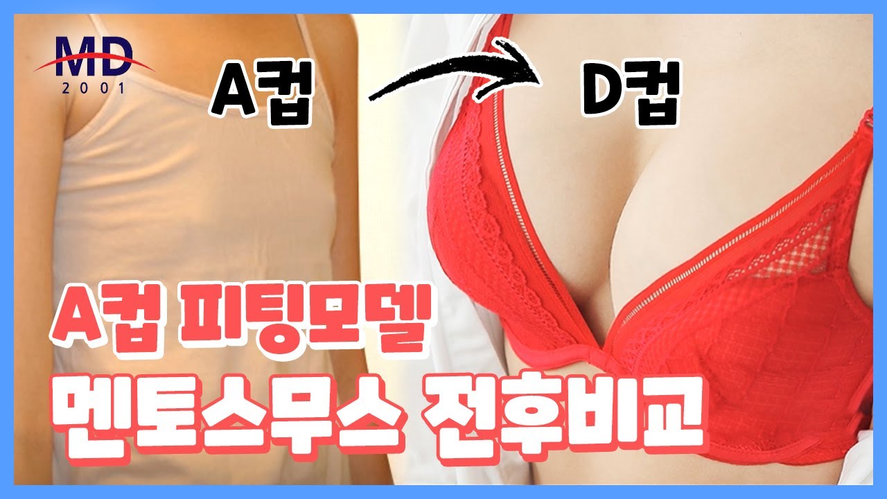 자연스러운 가슴성형, 서있을땐 물방울 누웠을땐 퍼지는 가슴 보형물이 있다? 모티바 보형물의 정체 확인하기 - Youtube