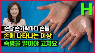 내 몸의 축소판 손 | 손바닥∙손가락∙손톱 색깔과 모양으로 보는 건강법! : 네이버 블로그