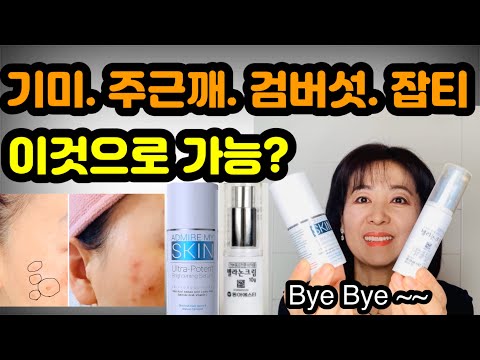 기미 제거 크림 미국: ‘좀 더 밝고 맑은 피부’를 위한 필수 아이템! 클릭하세요.