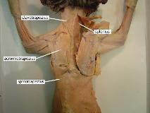 What Is The Origin Of The Acromiotrapezius Muscle?