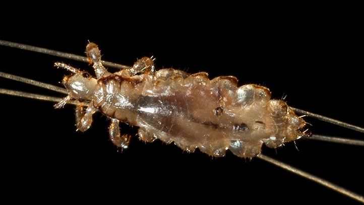 What Is Head Lice? Symptoms, Causes, Diagnosis, Treatment, And Prevention