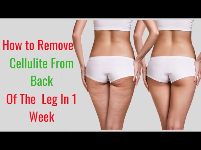 How To Remove Cellulite From The Back Of Legs In A Week - Youtube